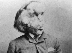 Cruel experiments, heartlessness and groping. How was the  freaks of nature  treated in the past? 