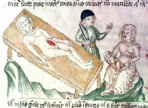 Исключительно жесткая мать, или как мир убеждал себя в кесаревом сечении 