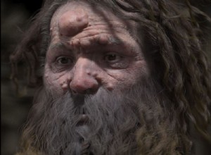 The Cro-Magnon man had his face covered in nodules 