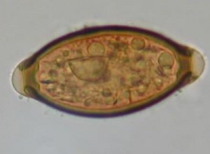 Parasitic infections were common in medieval Europe 